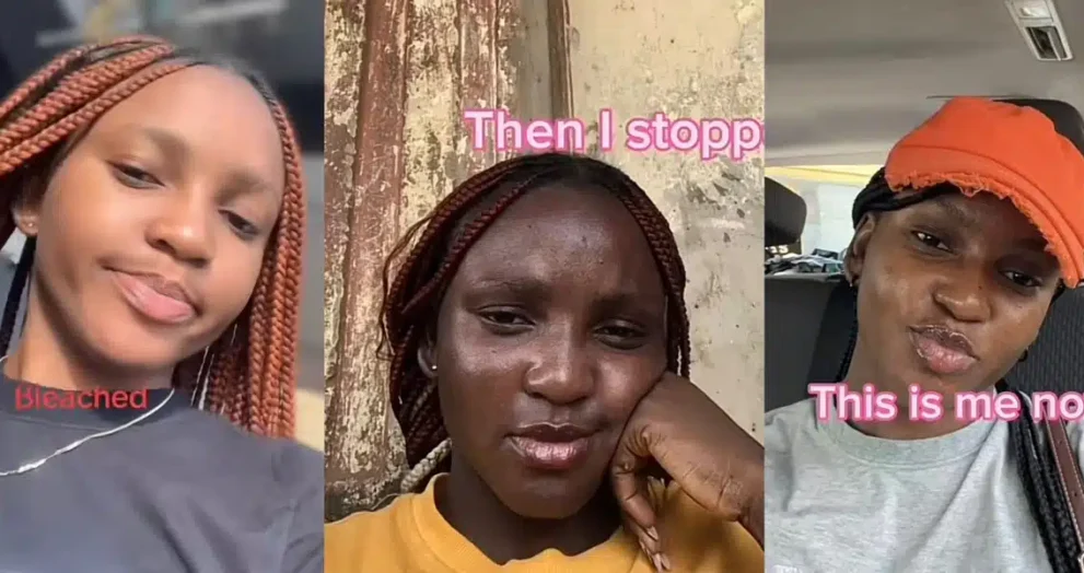 Lady shares her bleaching journey and how she made the tough decision to stop